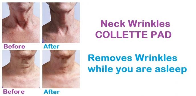 Prevent Neck wrinkles - Get yourself the investment of the life time